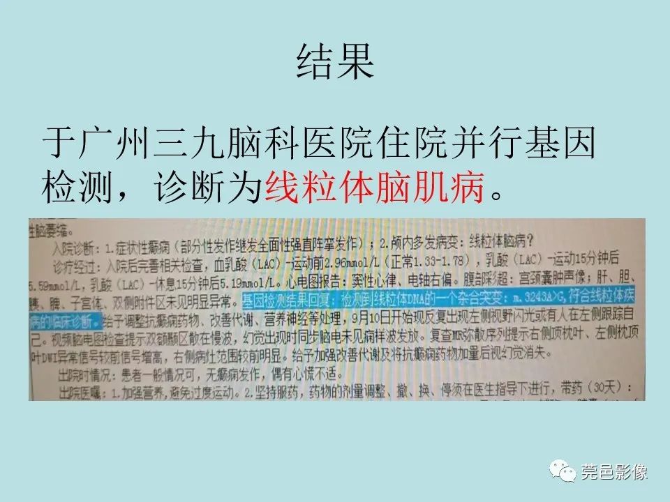 影像PPT - 【病例】线粒体脑肌病1例CT及MR-18