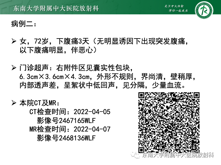 影像PPT - 【病例】附件扭转4例病例随访-4