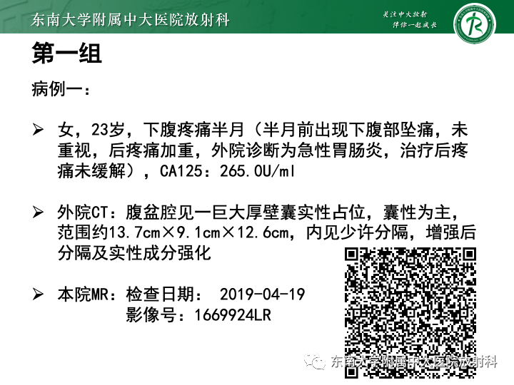 影像PPT - 【病例】附件扭转4例病例随访-1