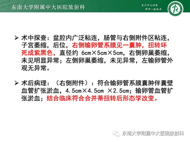 影像PPT - 【病例】附件扭转4例病例随访-7