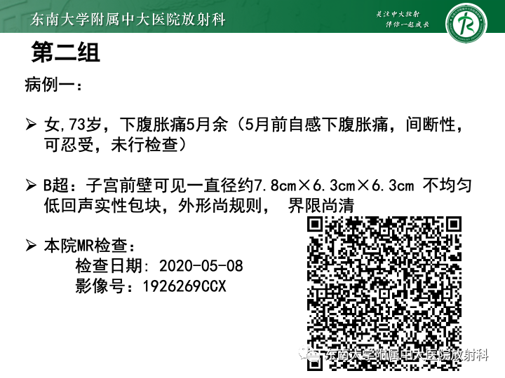 影像PPT - 【病例】附件扭转4例病例随访-8