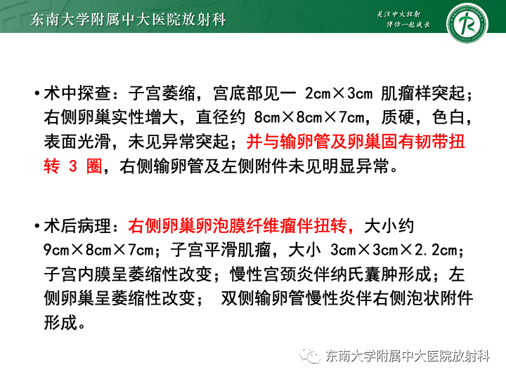 影像PPT - 【病例】附件扭转4例病例随访-10