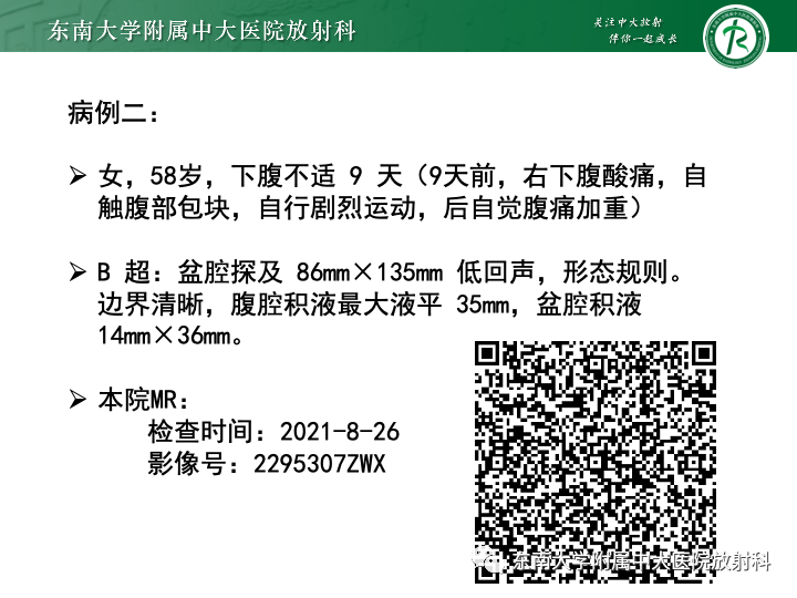 影像PPT - 【病例】附件扭转4例病例随访-11