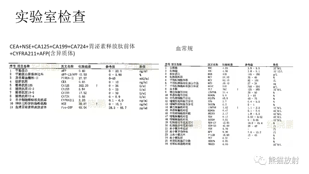 影像PPT - 【PPT】儿童及青少年前纵隔肿瘤-3