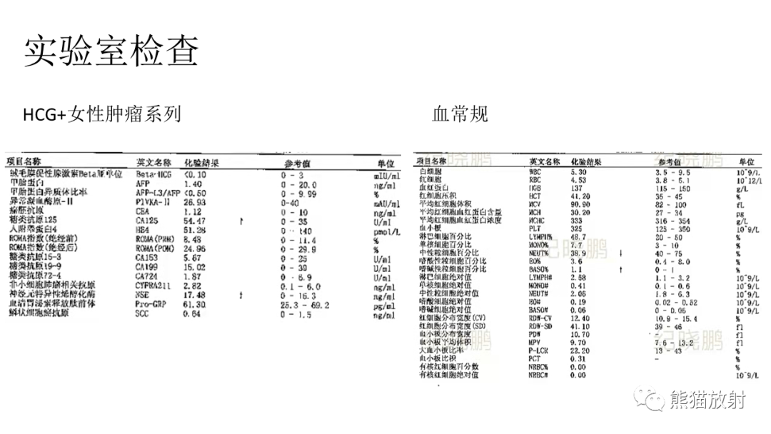 影像PPT - 【PPT】儿童及青少年前纵隔肿瘤-8
