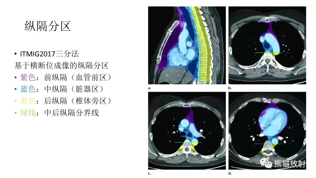 影像PPT - 【PPT】儿童及青少年前纵隔肿瘤-16