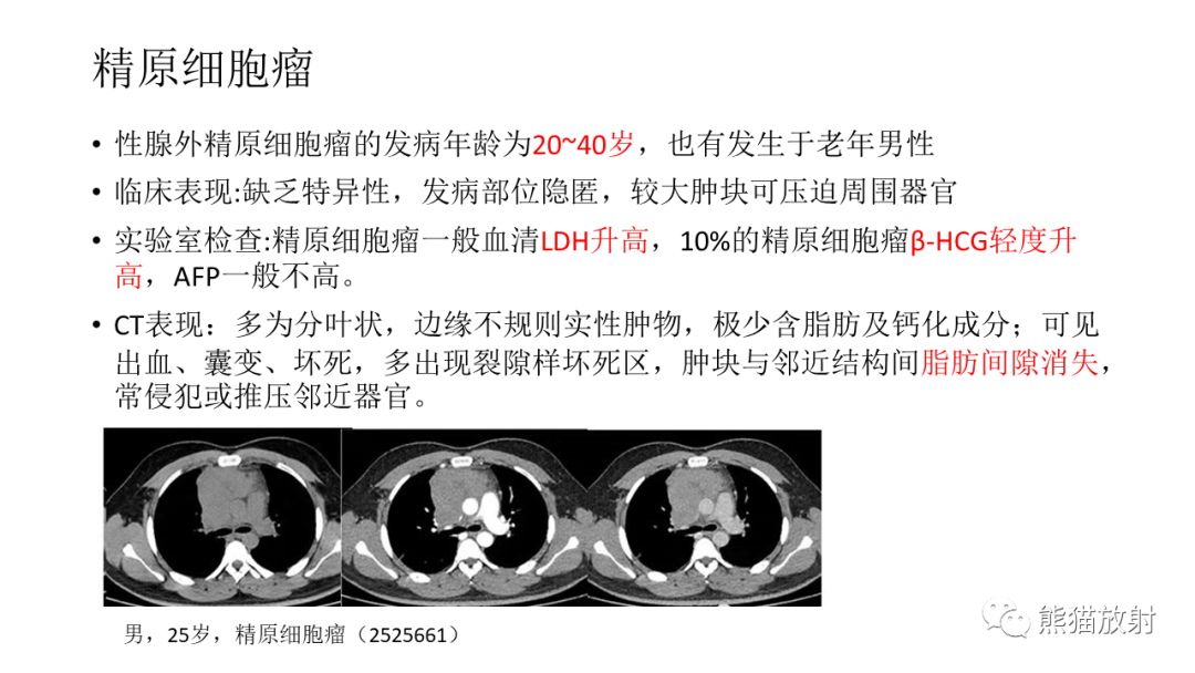 影像PPT - 【PPT】儿童及青少年前纵隔肿瘤-31