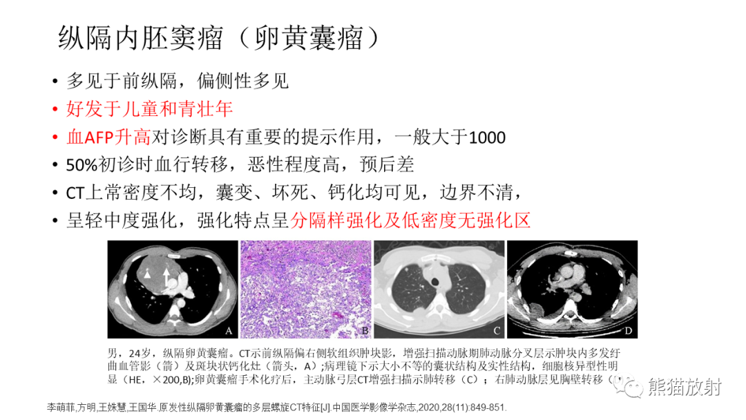 影像PPT - 【PPT】儿童及青少年前纵隔肿瘤-32