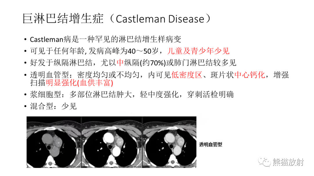 影像PPT - 【PPT】儿童及青少年前纵隔肿瘤-35