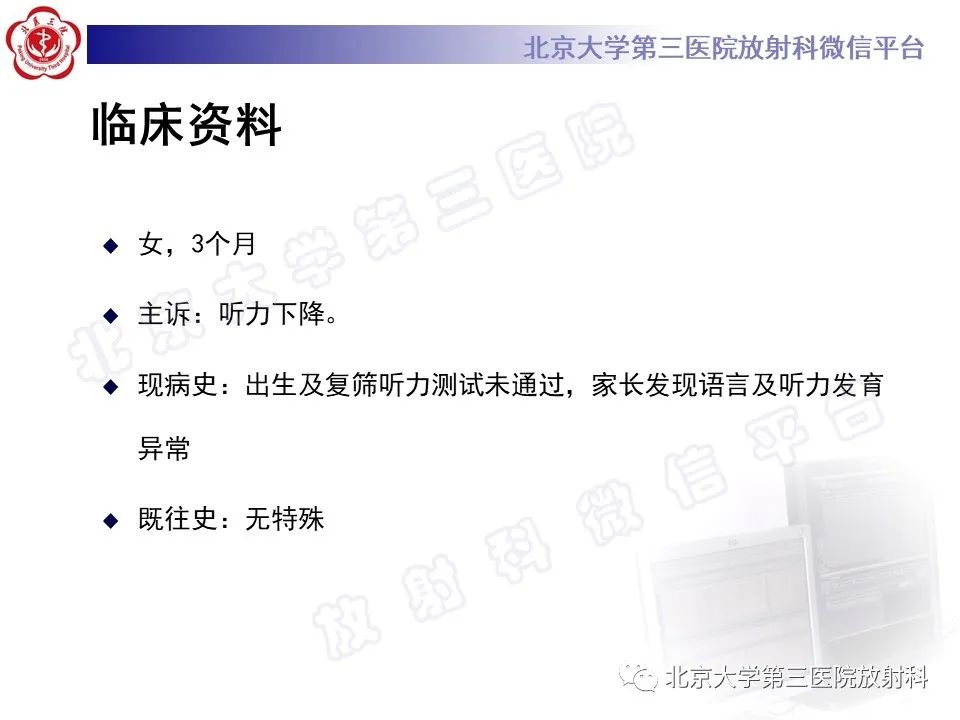影像PPT - 【PPT】内耳发育畸形-2