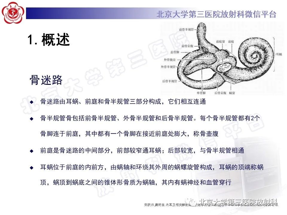 影像PPT - 【PPT】内耳发育畸形-12