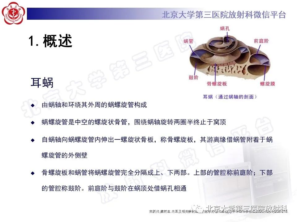影像PPT - 【PPT】内耳发育畸形-14