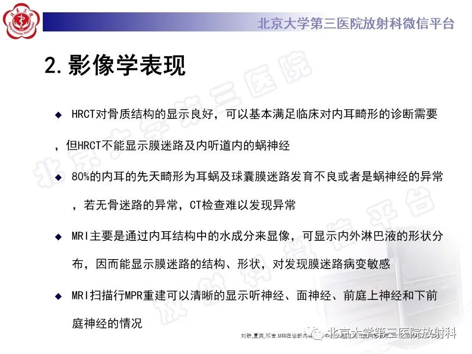 影像PPT - 【PPT】内耳发育畸形-15