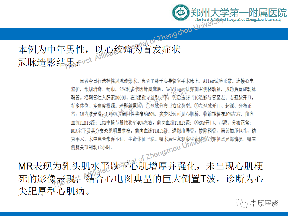 影像PPT - 【病例】心尖肥厚型心肌病1例MR影像-9