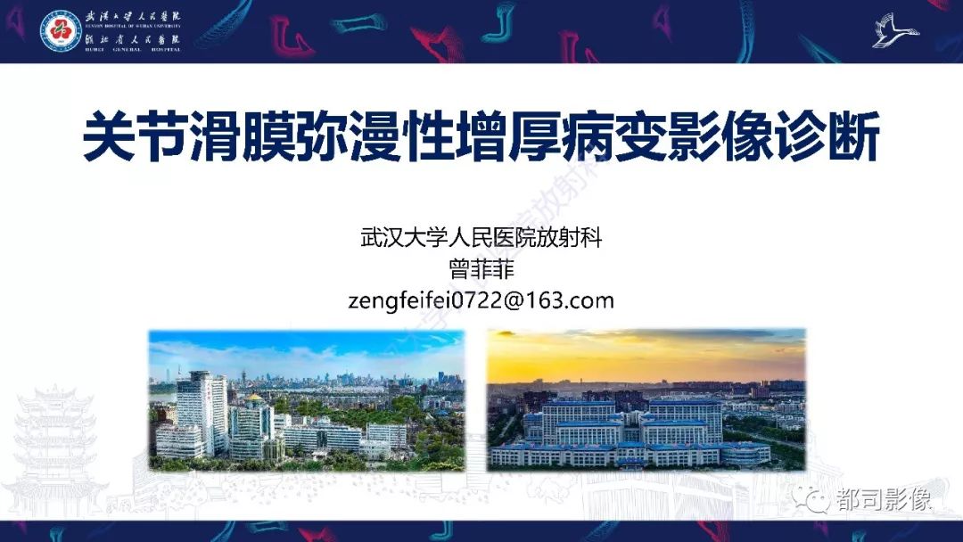 影像PPT - 【PPT】关节滑膜弥漫性增厚病变影像诊断-1