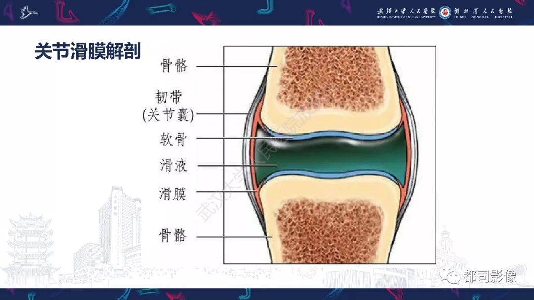 影像PPT - 【PPT】关节滑膜弥漫性增厚病变影像诊断-3