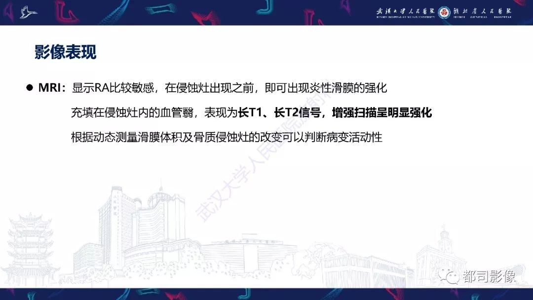 影像PPT - 【PPT】关节滑膜弥漫性增厚病变影像诊断-11