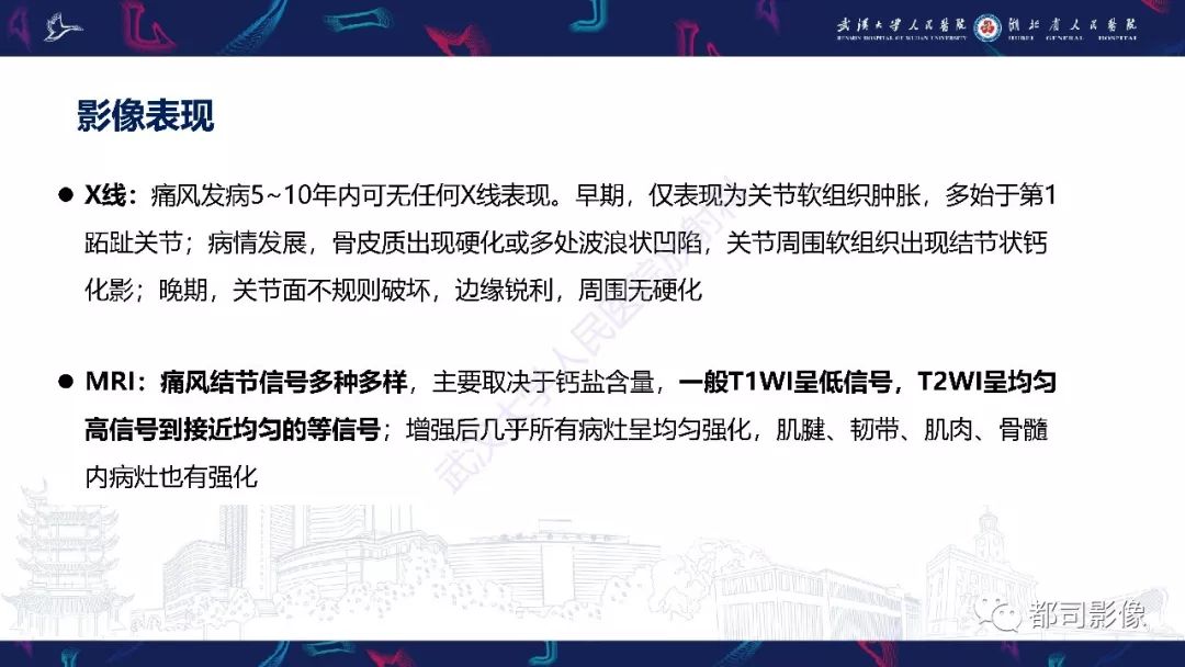 影像PPT - 【PPT】关节滑膜弥漫性增厚病变影像诊断-16