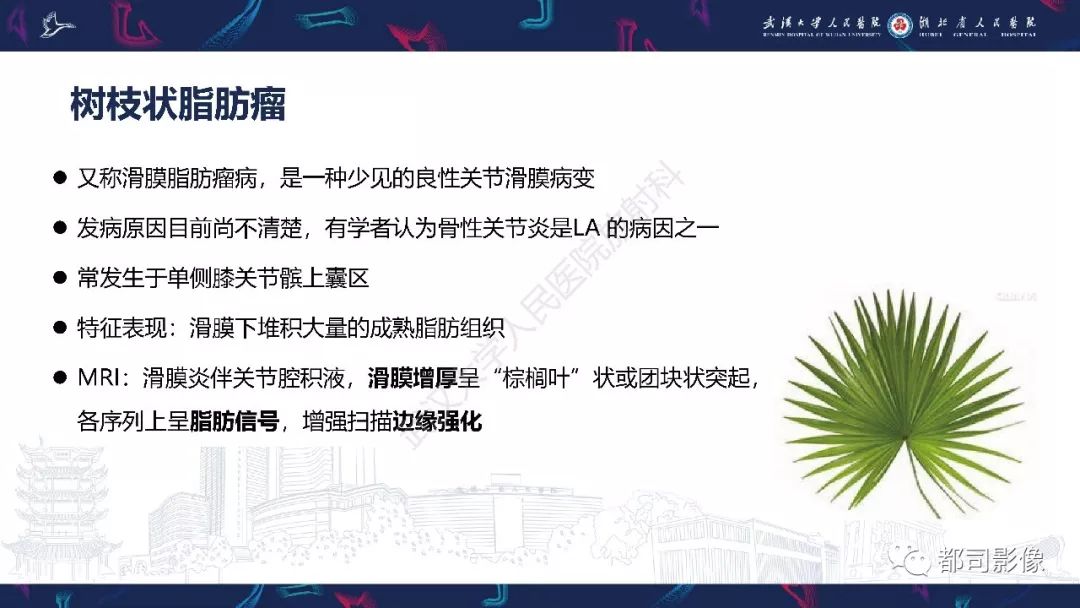 影像PPT - 【PPT】关节滑膜弥漫性增厚病变影像诊断-25