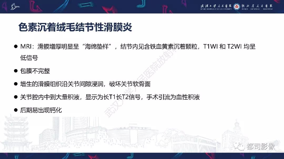 影像PPT - 【PPT】关节滑膜弥漫性增厚病变影像诊断-29
