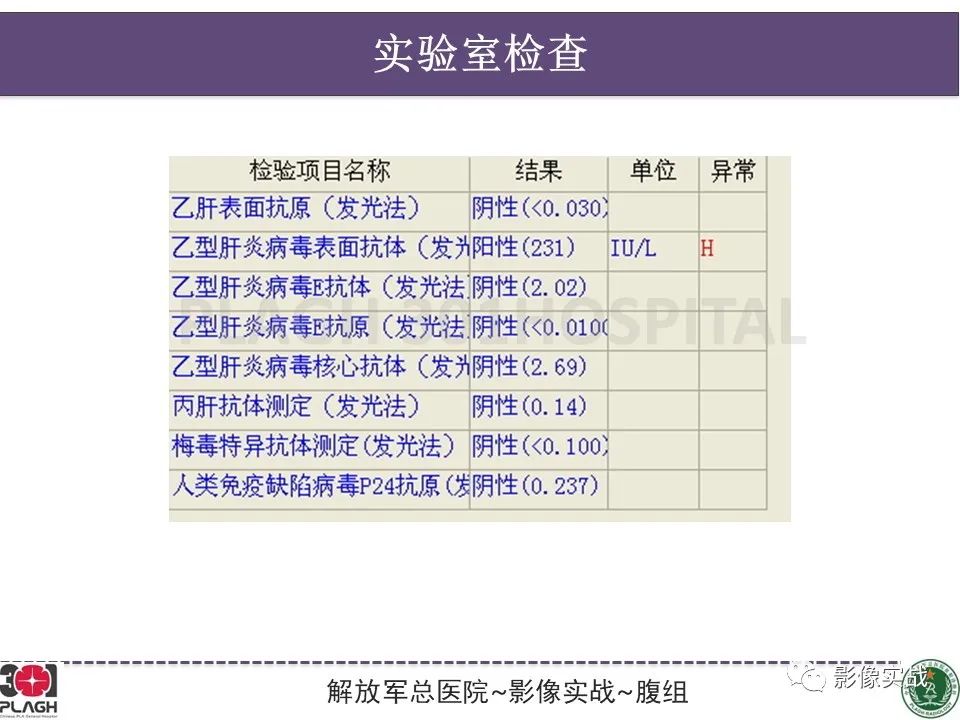 影像PPT - 【病例】肝内胆管细胞癌1例MR影像-4