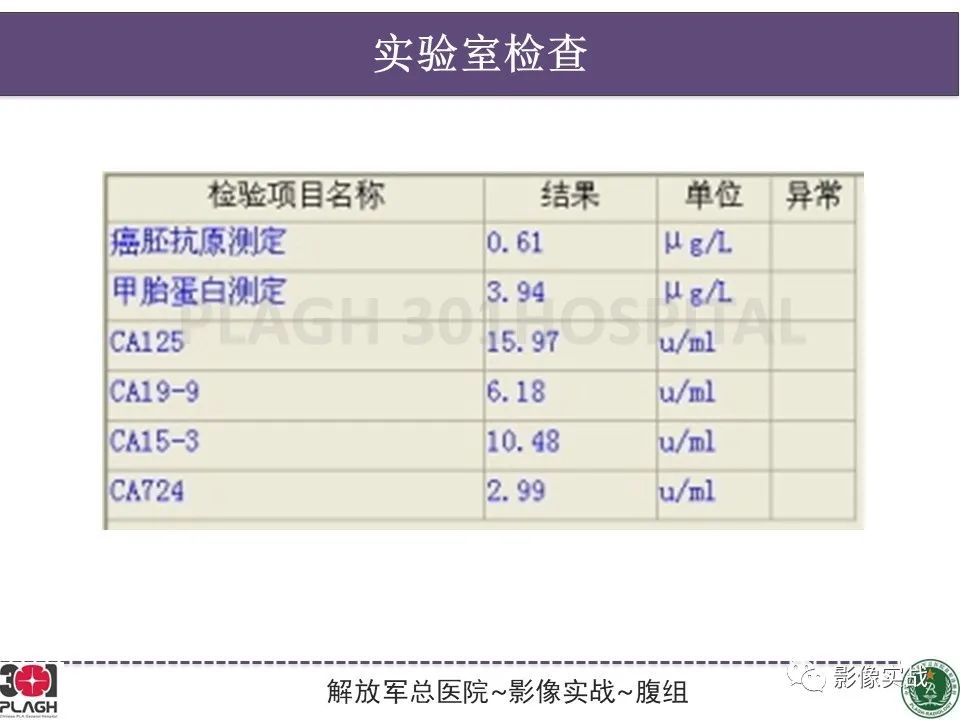 影像PPT - 【病例】肝内胆管细胞癌1例MR影像-3