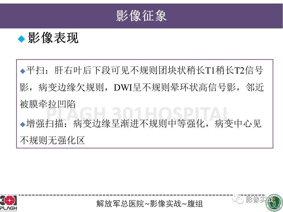影像PPT - 【病例】肝内胆管细胞癌1例MR影像-20