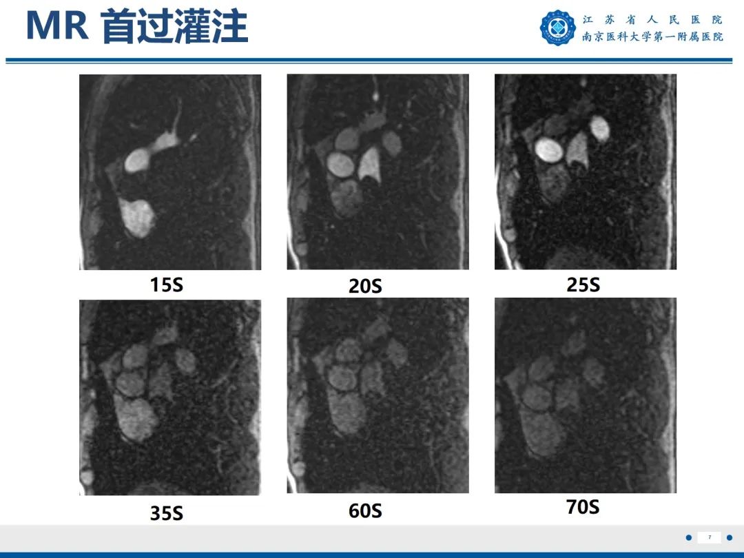 影像PPT - 【PPT】心脏黏液瘤—心脏肿瘤MR评估-8