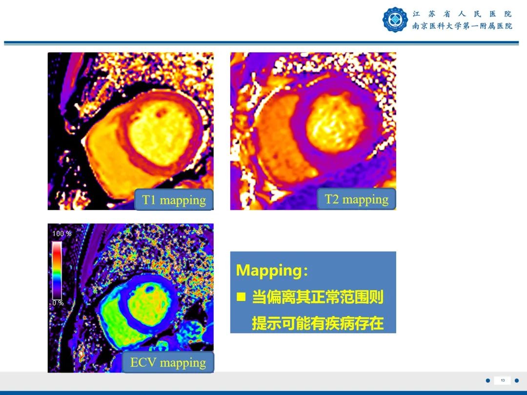 影像PPT - 【PPT】心脏黏液瘤—心脏肿瘤MR评估-14