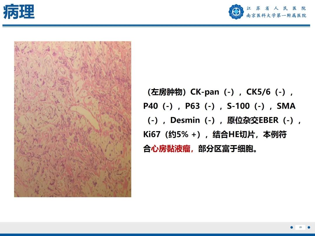 影像PPT - 【PPT】心脏黏液瘤—心脏肿瘤MR评估-24