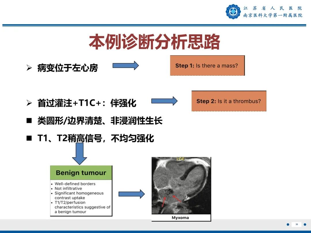 影像PPT - 【PPT】心脏黏液瘤—心脏肿瘤MR评估-39