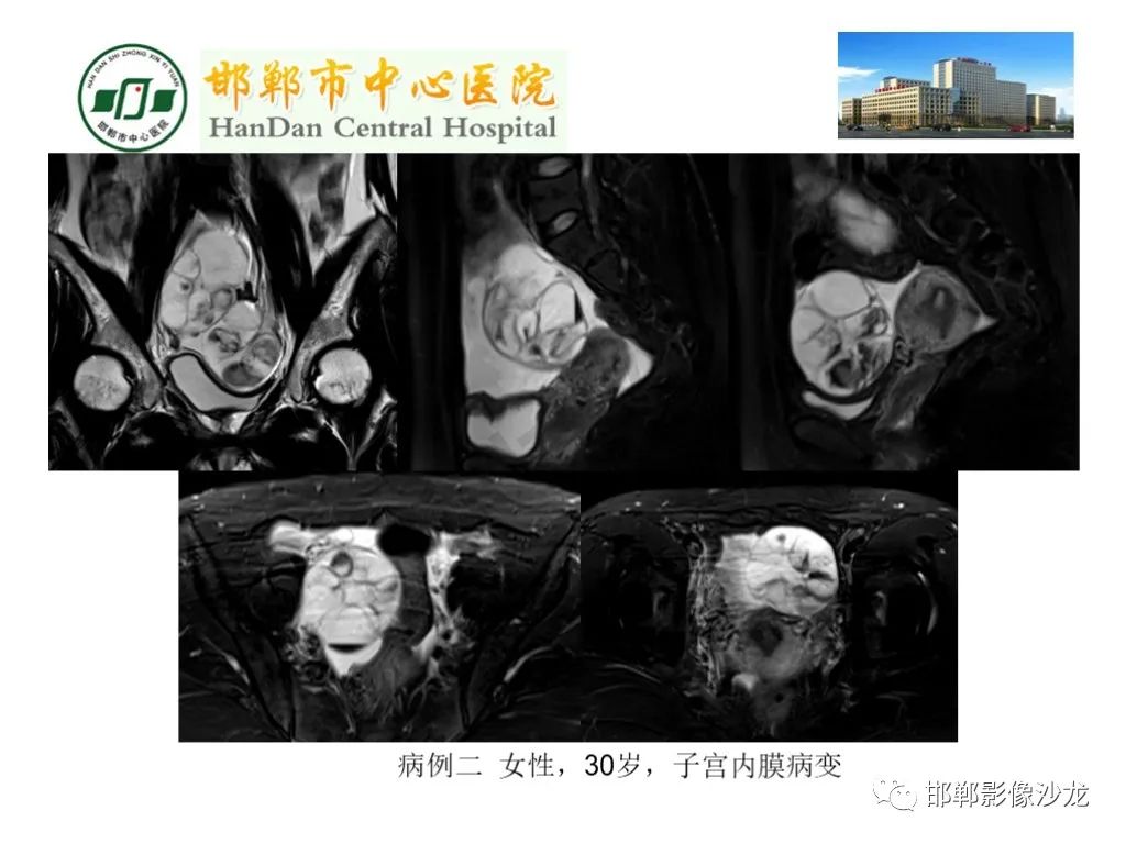 影像PPT - 【PPT】卵巢非肿瘤性病变的影像诊断-3