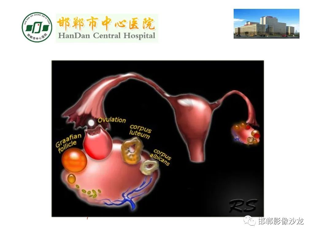 影像PPT - 【PPT】卵巢非肿瘤性病变的影像诊断-7
