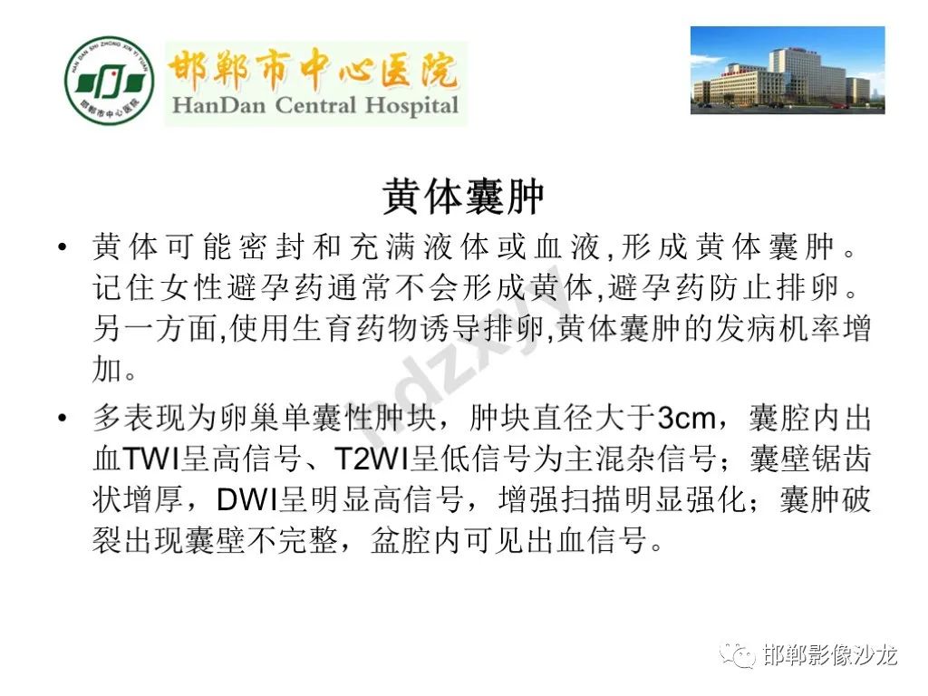 影像PPT - 【PPT】卵巢非肿瘤性病变的影像诊断-16
