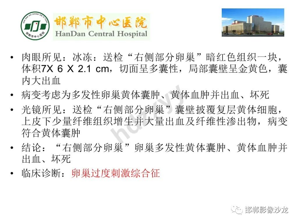 影像PPT - 【PPT】卵巢非肿瘤性病变的影像诊断-42
