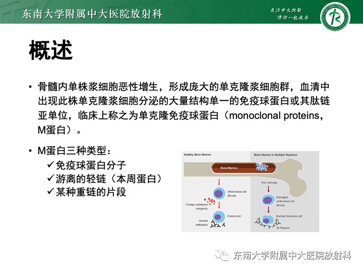 影像PPT - 【PPT】多发性骨髓瘤-9 影像PPT - 【PPT】多发性骨髓瘤-9