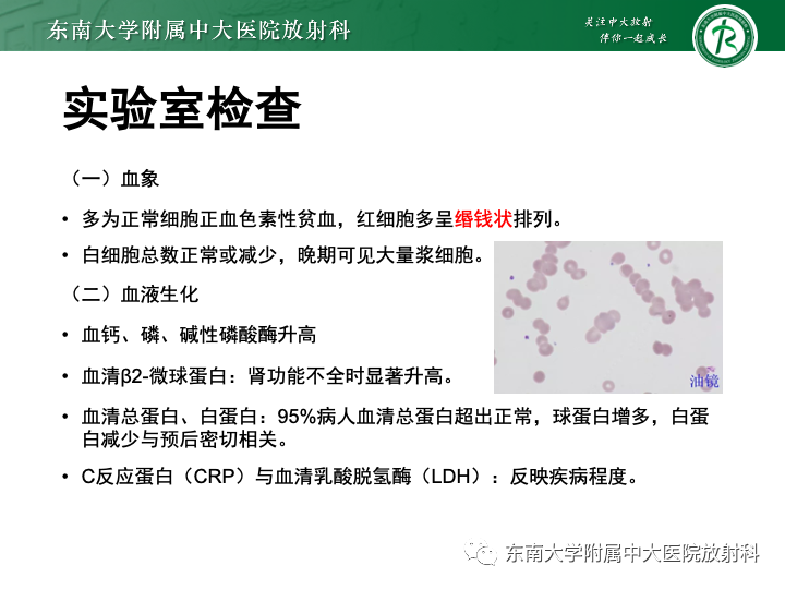 影像PPT - 【PPT】多发性骨髓瘤-13 影像PPT - 【PPT】多发性骨髓瘤-13