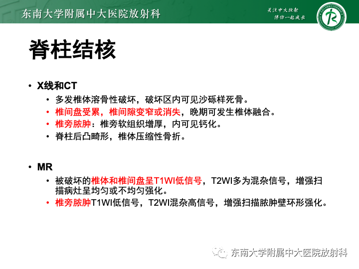 影像PPT - 【PPT】多发性骨髓瘤-30 影像PPT - 【PPT】多发性骨髓瘤-30