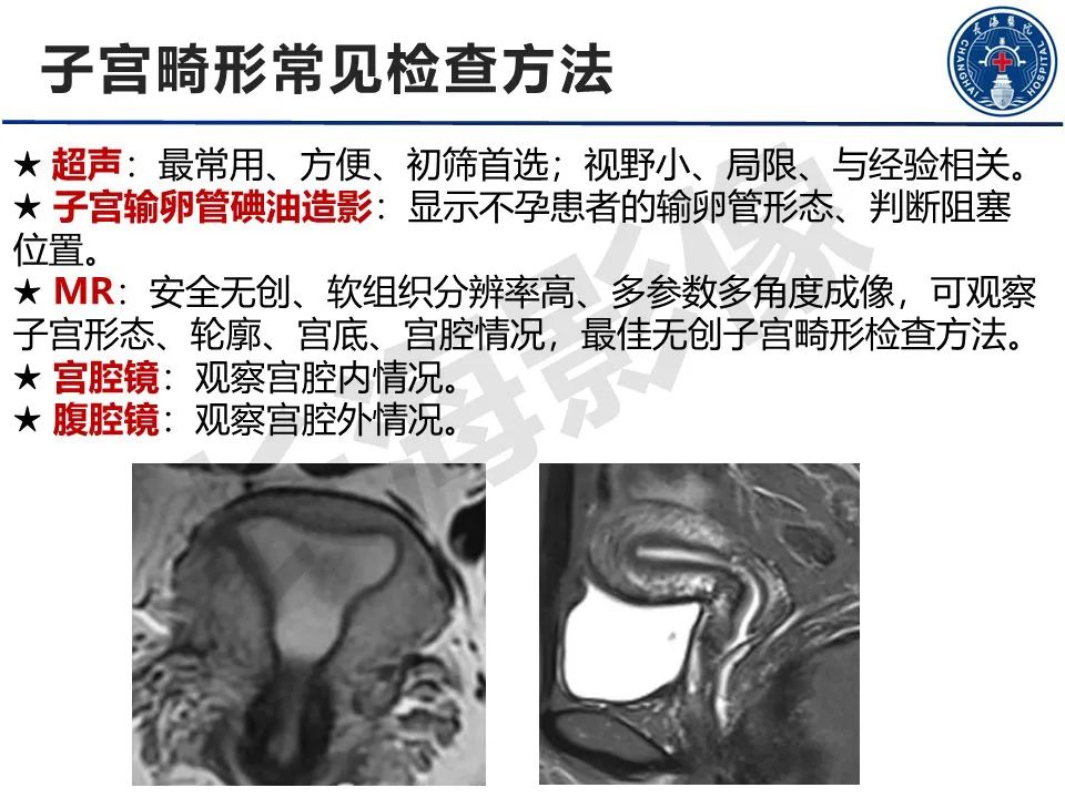 影像PPT - 【PPT】子宫畸形的分类及MR诊断-3