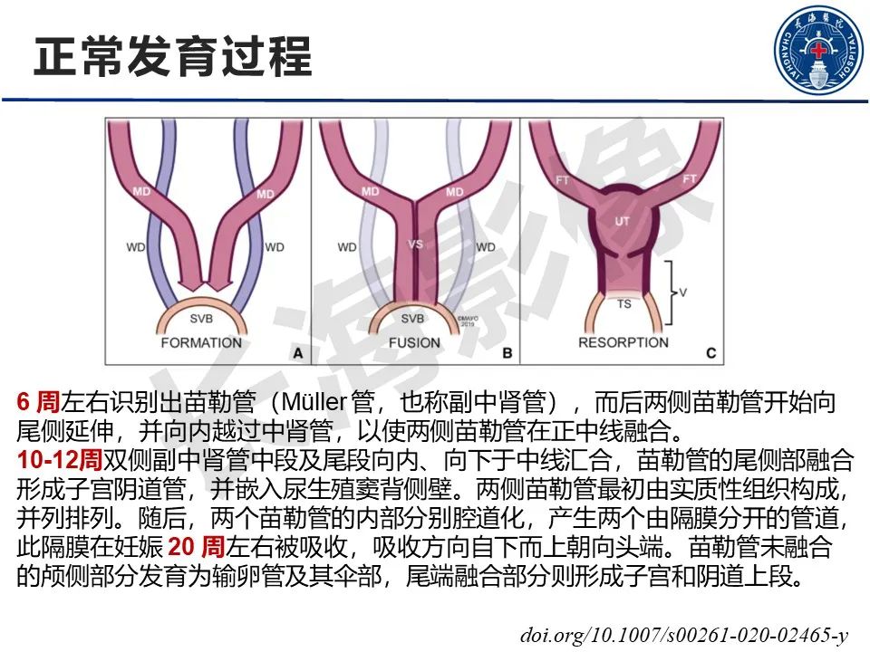 影像PPT - 【PPT】子宫畸形的分类及MR诊断-4