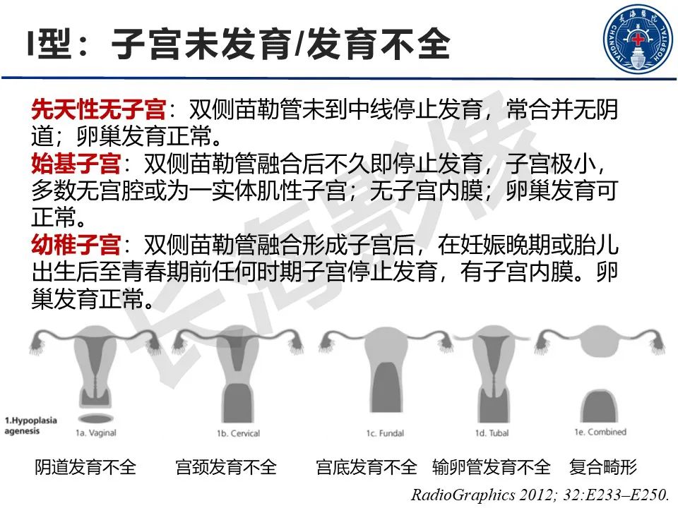 影像PPT - 【PPT】子宫畸形的分类及MR诊断-7