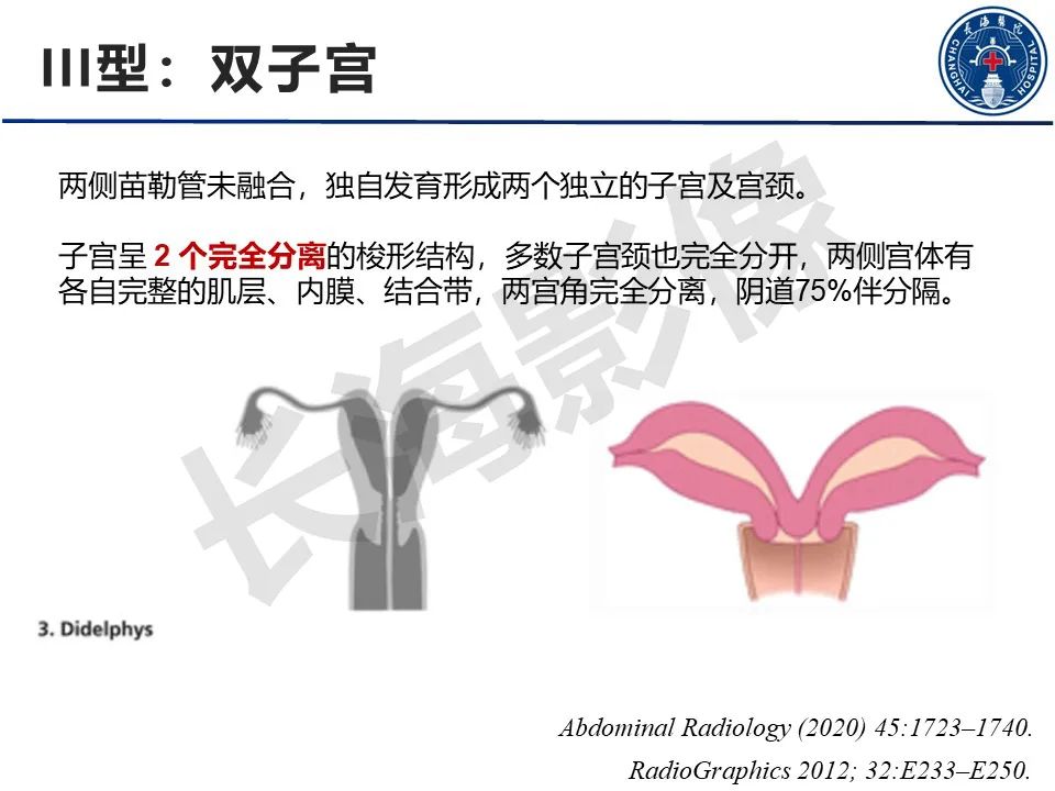 影像PPT - 【PPT】子宫畸形的分类及MR诊断-12