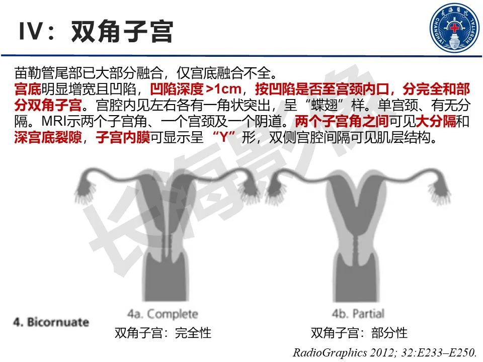 影像PPT - 【PPT】子宫畸形的分类及MR诊断-15