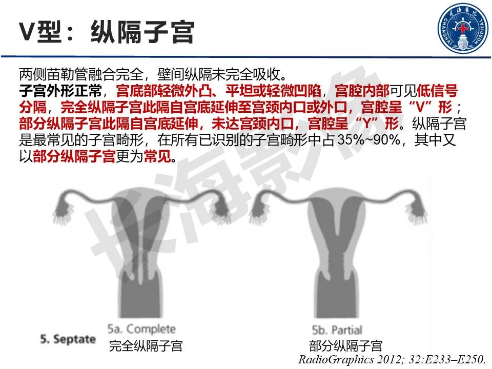 影像PPT - 【PPT】子宫畸形的分类及MR诊断-17