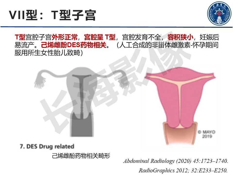 影像PPT - 【PPT】子宫畸形的分类及MR诊断-21