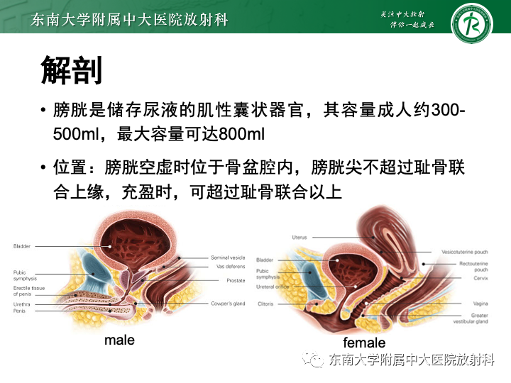 影像PPT - 【PPT】腺性膀胱炎-6 影像PPT - 【PPT】腺性膀胱炎-6