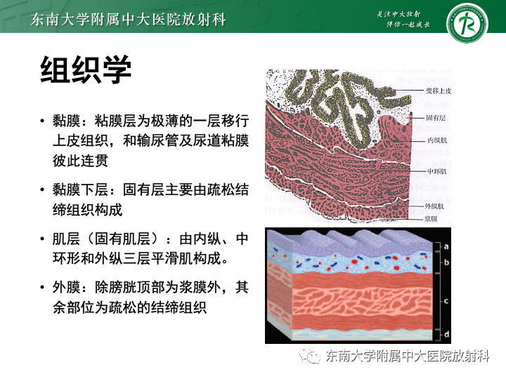 影像PPT - 【PPT】腺性膀胱炎-8 影像PPT - 【PPT】腺性膀胱炎-8