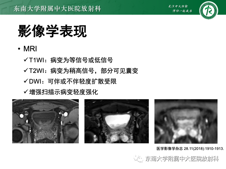 影像PPT - 【PPT】腺性膀胱炎-18 影像PPT - 【PPT】腺性膀胱炎-18