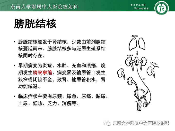 影像PPT - 【PPT】腺性膀胱炎-29 影像PPT - 【PPT】腺性膀胱炎-29