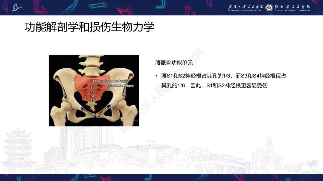 影像PPT - 【PPT】骶骨骨折CT评估-4